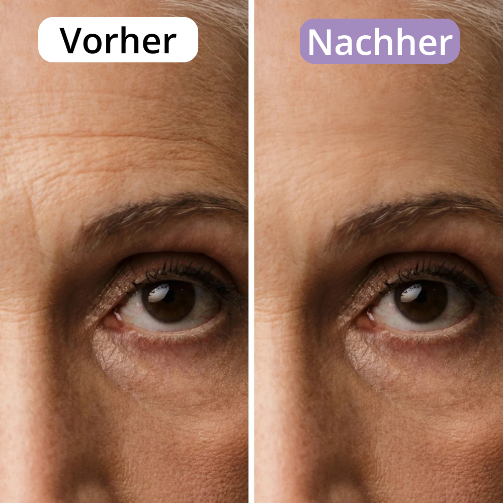 AveraSkin - Silikonpflaster gegen Narben und Falten