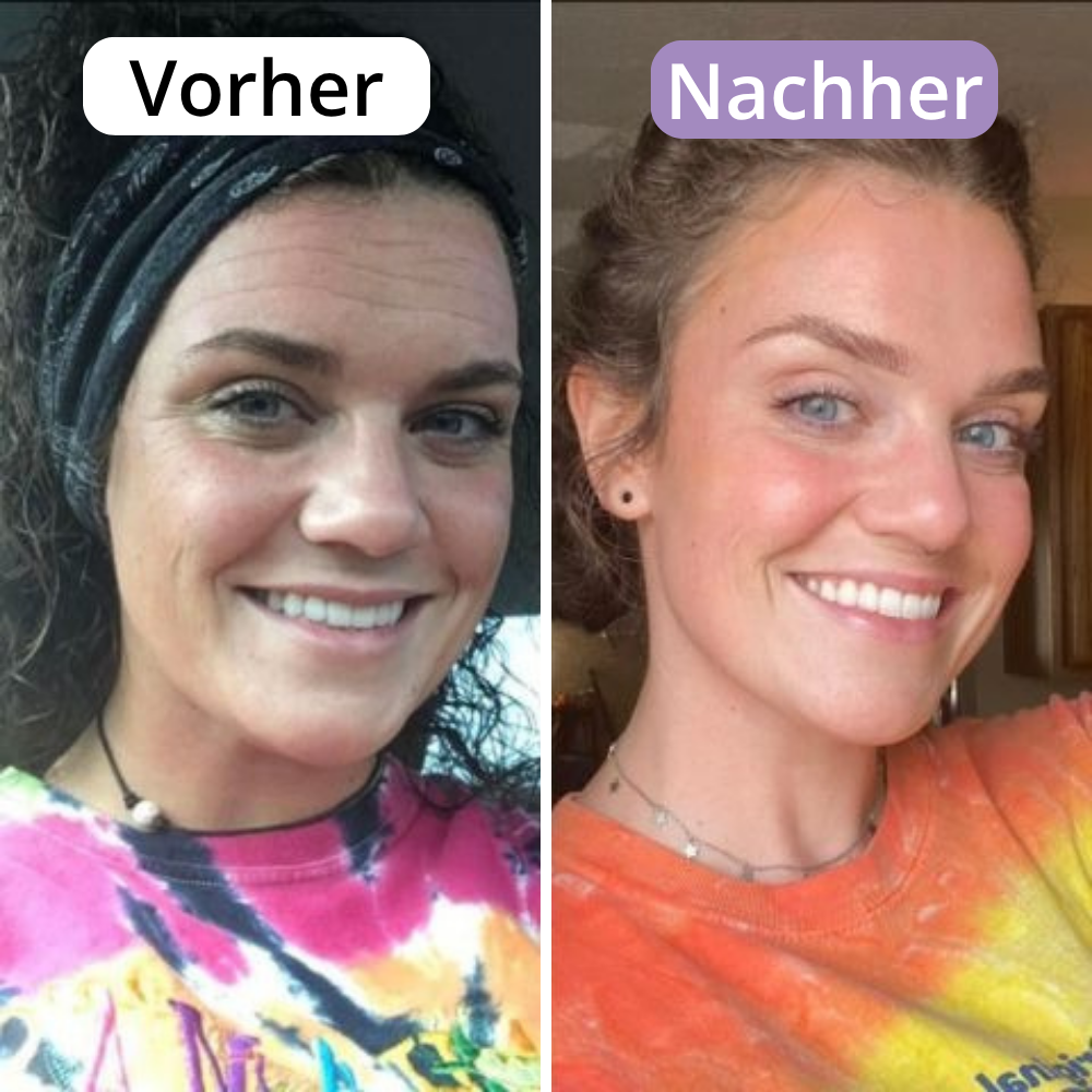 AveraSkin - Silikonpflaster gegen Falten